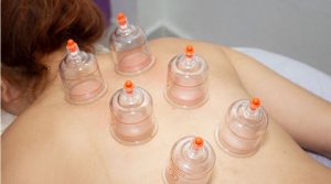 Curso ventosaterapia certificado