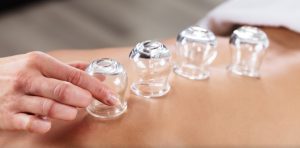 10 benefícios da ventosaterapia para o corpo